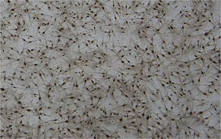 PL 150 shrimp larval feed PL 150 shrimp larval feed